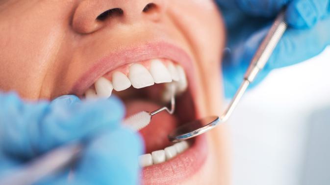 4 Tips Atasi Sakit Gigi Bungsu yang Sedang Tumbuh